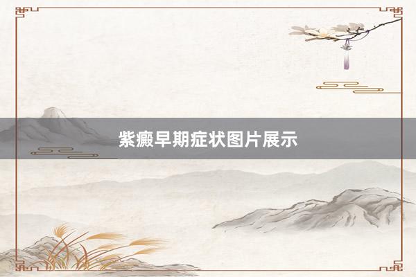 紫癜早期症状图片展示